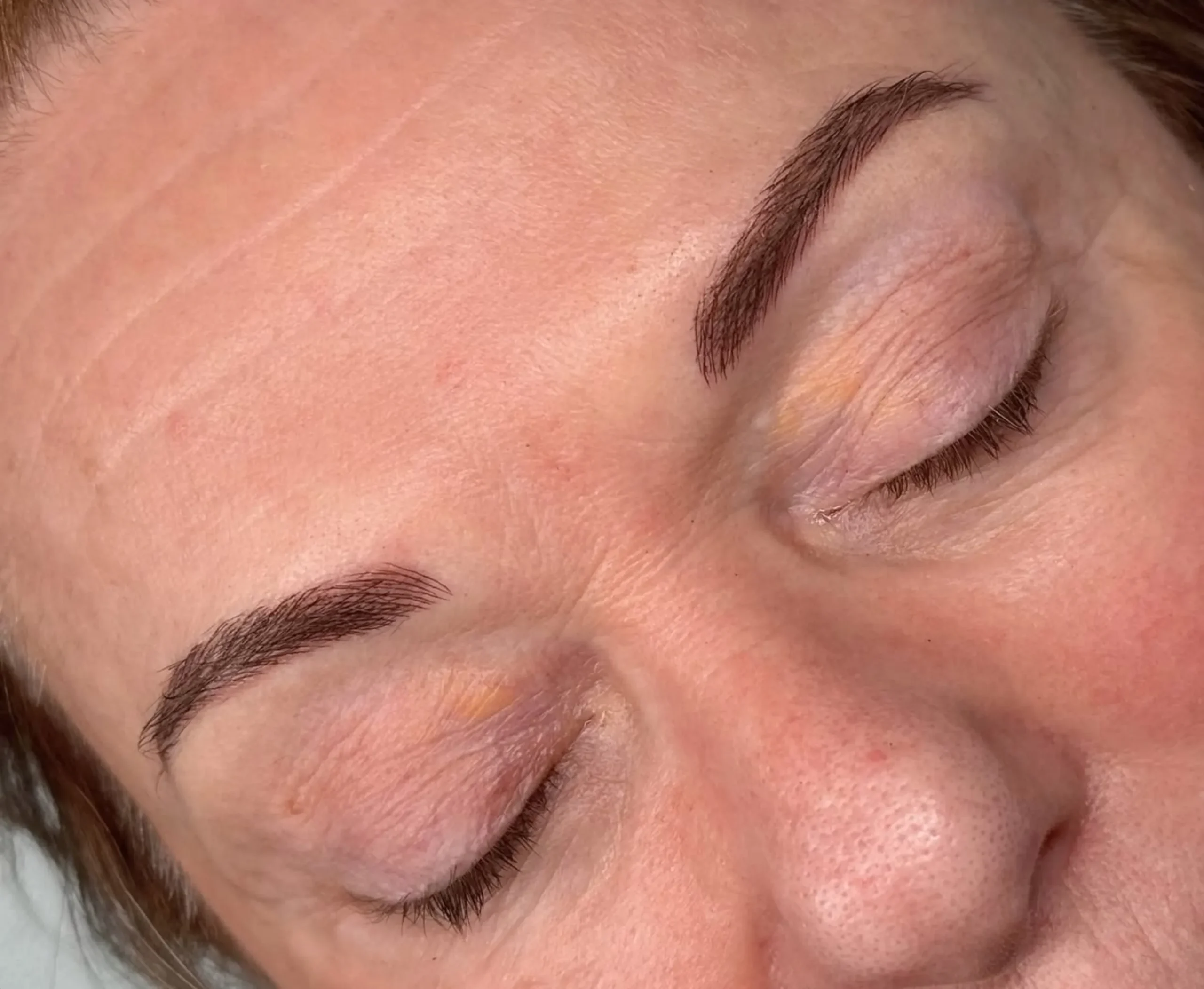 patchy microblading results