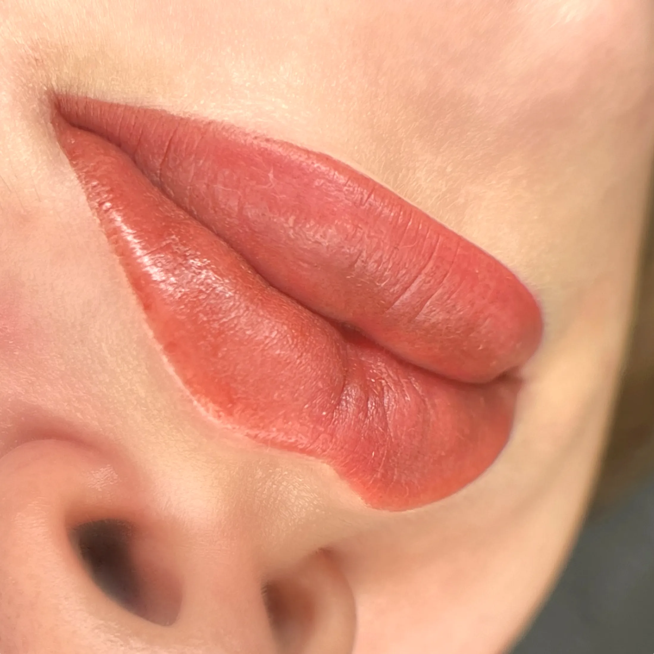 lip blush after lip injections