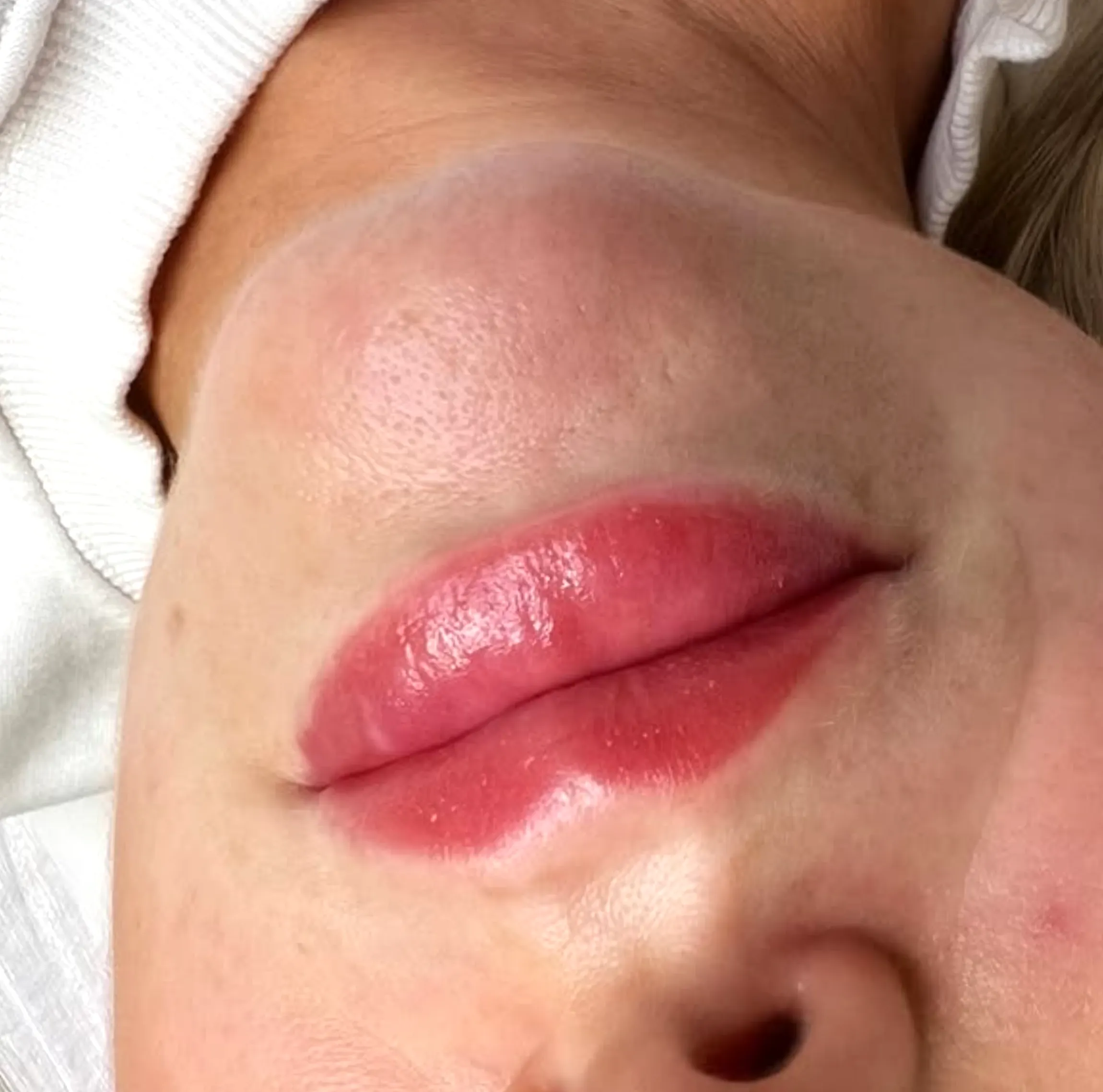 cosmetic tattooing lips with fillers