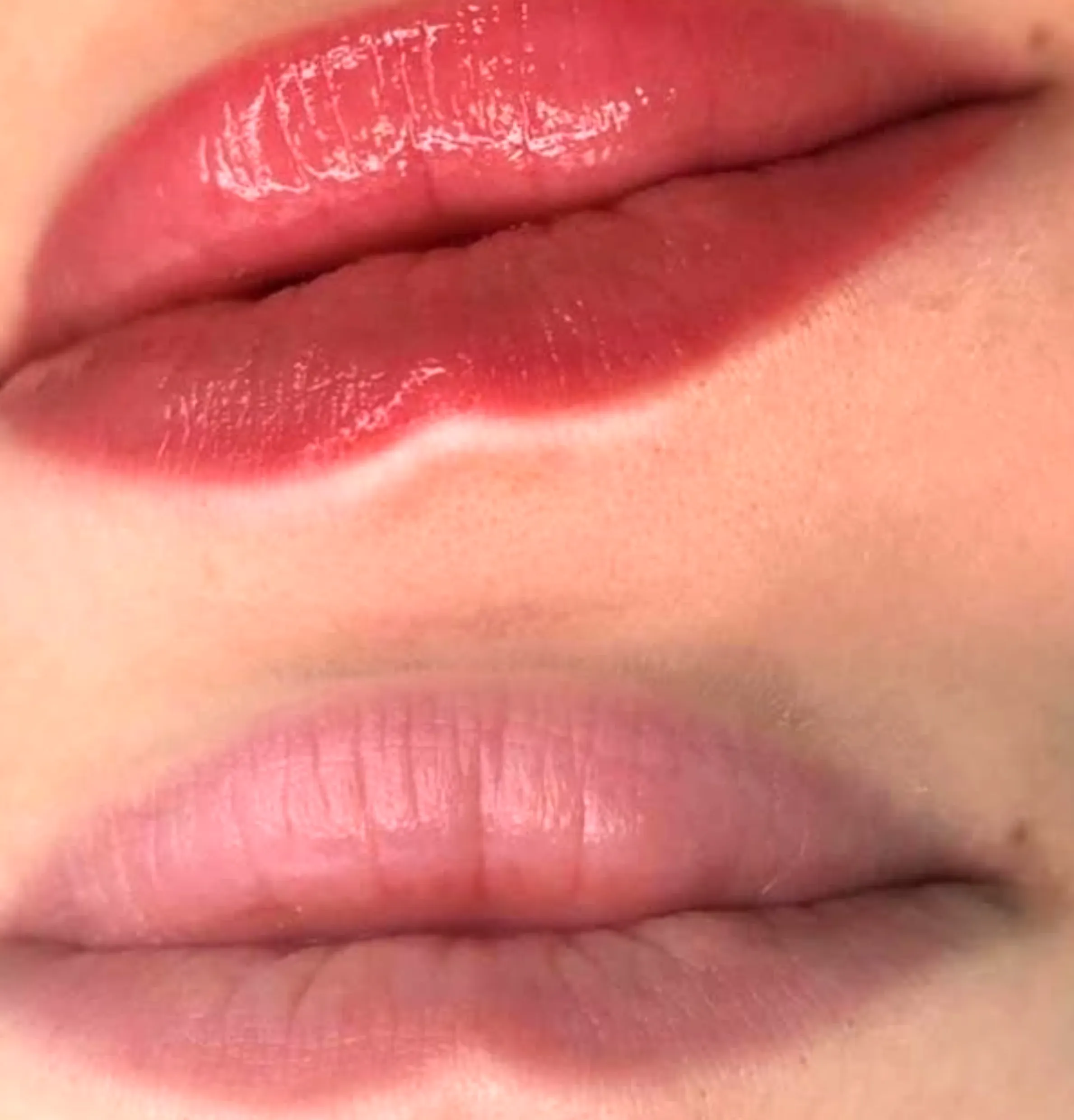 lip blush healing with fillers