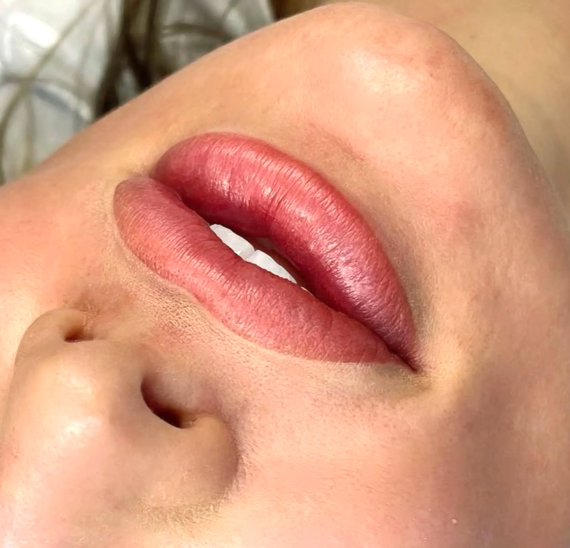 lip blush with fillers
