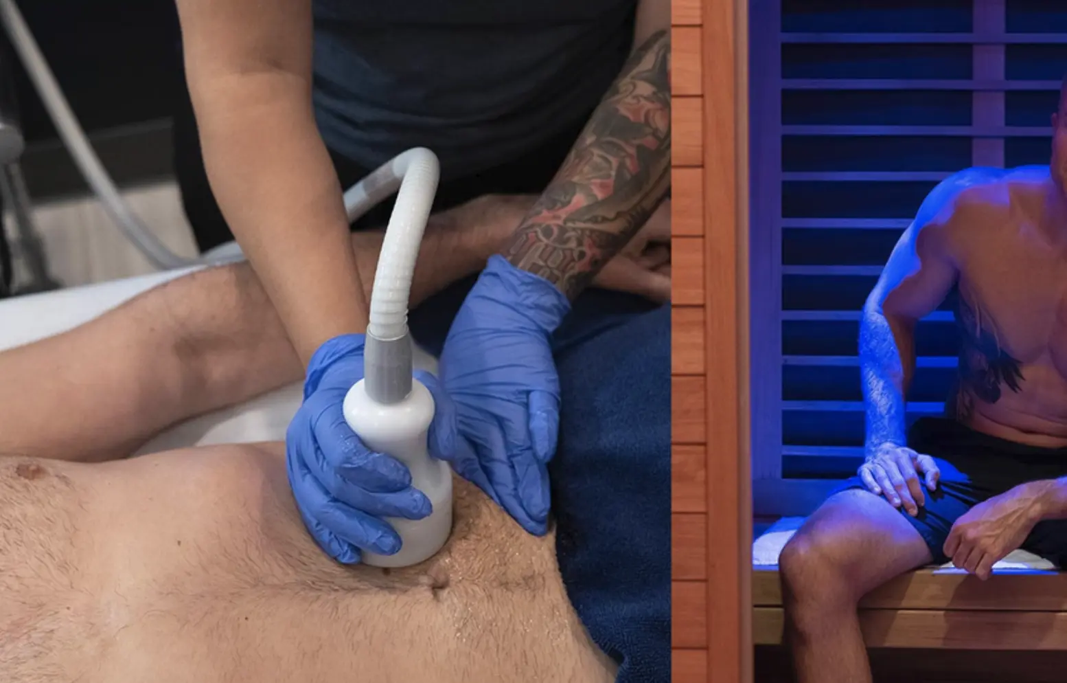 cryoskin vs emsculpt